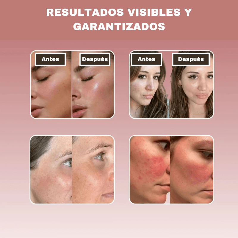 Mascarilla de Biocolágeno