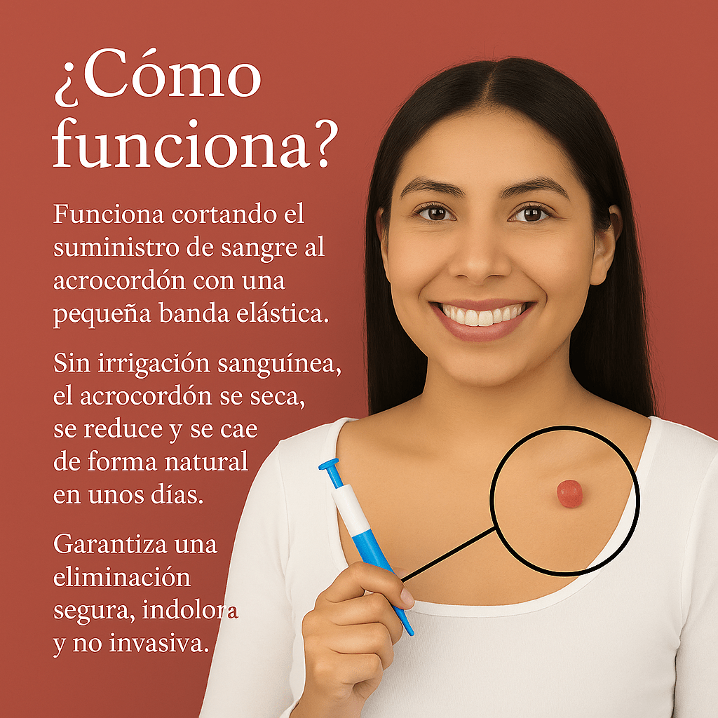 Brivori™ – Elimina acrocordones de forma segura en casa