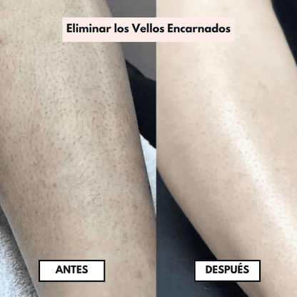 PureSkin™  – Afeitadora eléctrica para mujer
