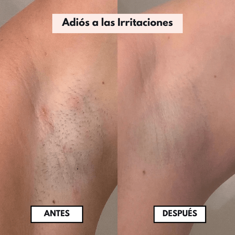 PureSkin™  – Afeitadora eléctrica para mujer