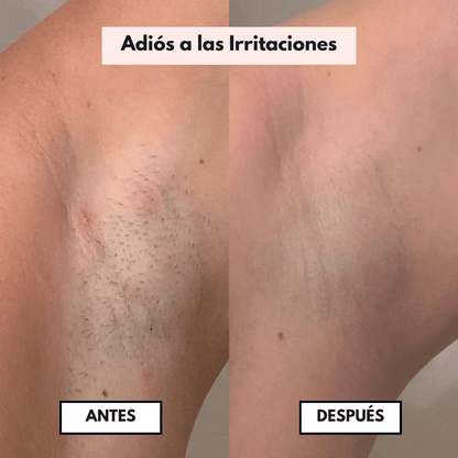 PureSkin™  – Afeitadora eléctrica para mujer