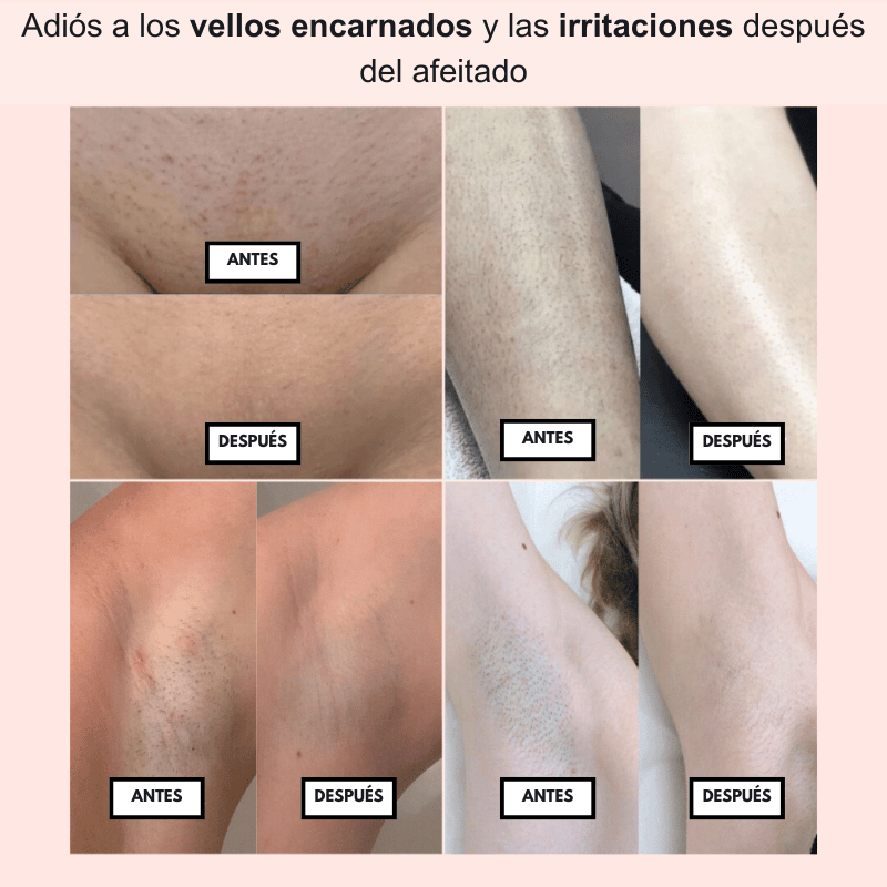 PureSkin™  – Afeitadora eléctrica para mujer