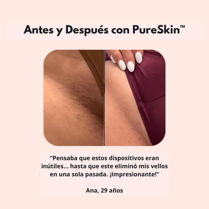 PureSkin™  – Afeitadora eléctrica para mujer